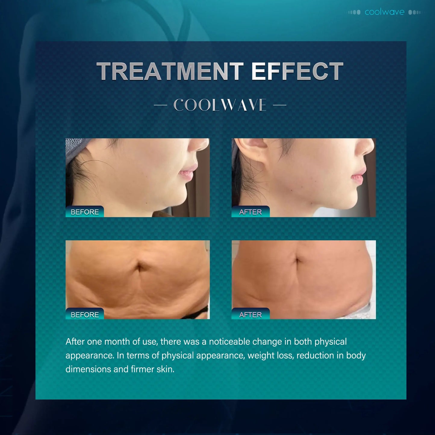 New Advanced Ice-Microwave Slimming Machine Weight Loss Anti-aging Promote Collagen Production Non-invasive Slimming Machine