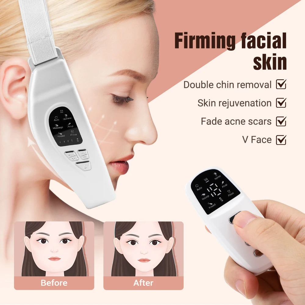 Face lifting Device Red Light Skin Rejuvenation V Face Massager Double Chin Lift Up with Remote Control Facial Beauty Instrument