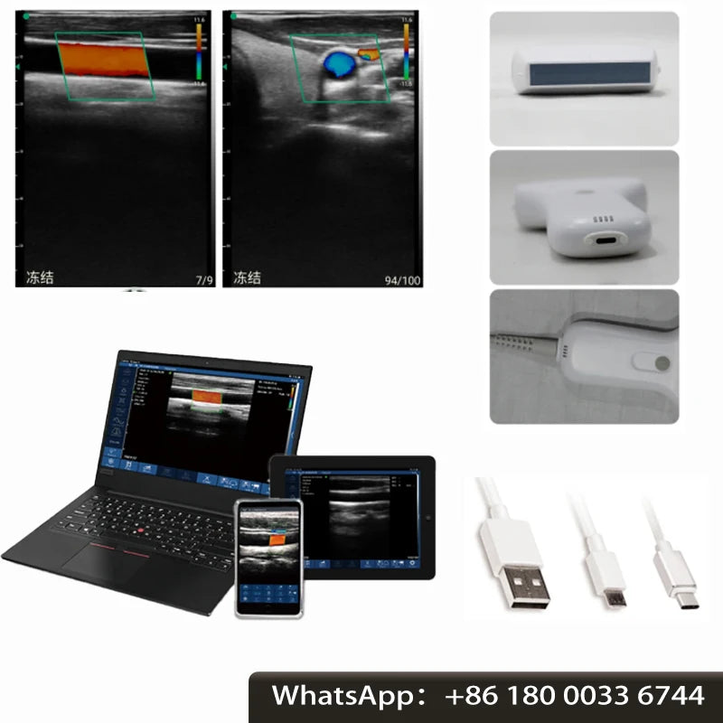 Portable Wireless Ultrasound Probe scanner machine WIFI ultrasound scanner Machine support iOS Android Windows free suitcase